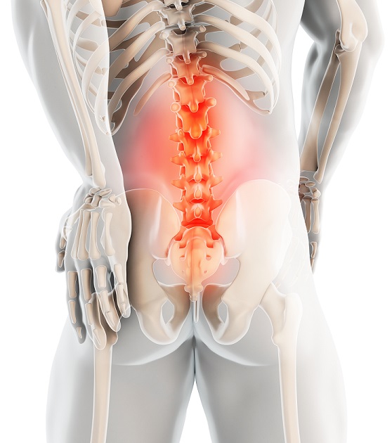 The Anatomy of Lower Back Pain, Low Back Pain