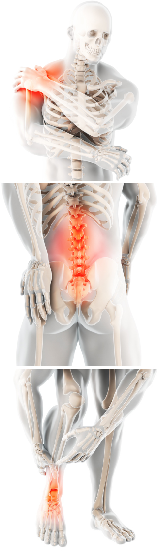 Fast Facts: Low Back Pain-OA   - The University